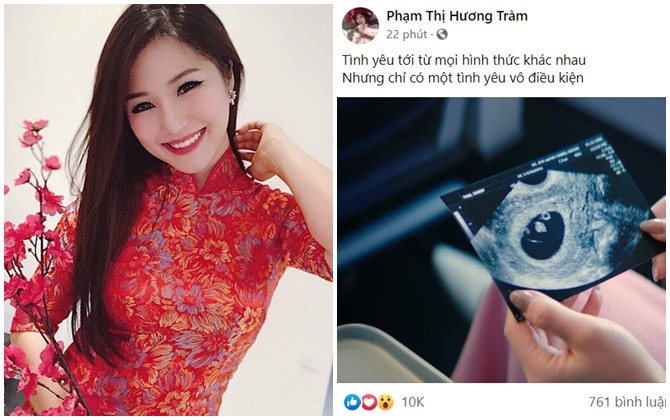 Hương Tràm công khai ảnh siêu âm, có thai sau 2 năm sang Mỹ?