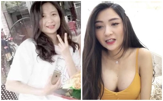 Anh Thư 'Về Nhà Đi Con' lộ ảnh quá khứ 'vịt bầu', công khai nâng ngực