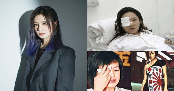 Liên hoàn scandal chấn động của Triệu Vy: Từ bị tố vô ơn, ngoại tình cho tới hành hung phụ nữ mang thai