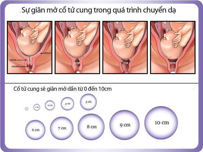 Nhận biết dấu hiệu sắp sinh trước 2 ngày cho mẹ chuẩn bị tinh thần đón bé yêu chào đời