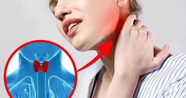 Ung thư tuyến giáp: 5 thói quen ăn uống gây bệnh mà nhiều người mắc phải