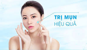 Top 5 sản phẩm dược mỹ phẩm trị mụn hiệu quả nhất hiện nay