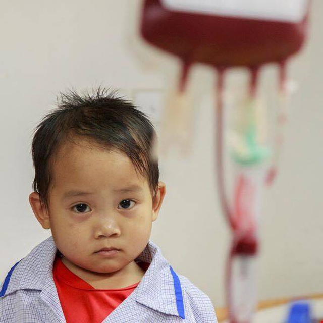 Bệnh Thalassemia là bệnh gì? Tuổi thọ của người bị bệnh Thalassemia