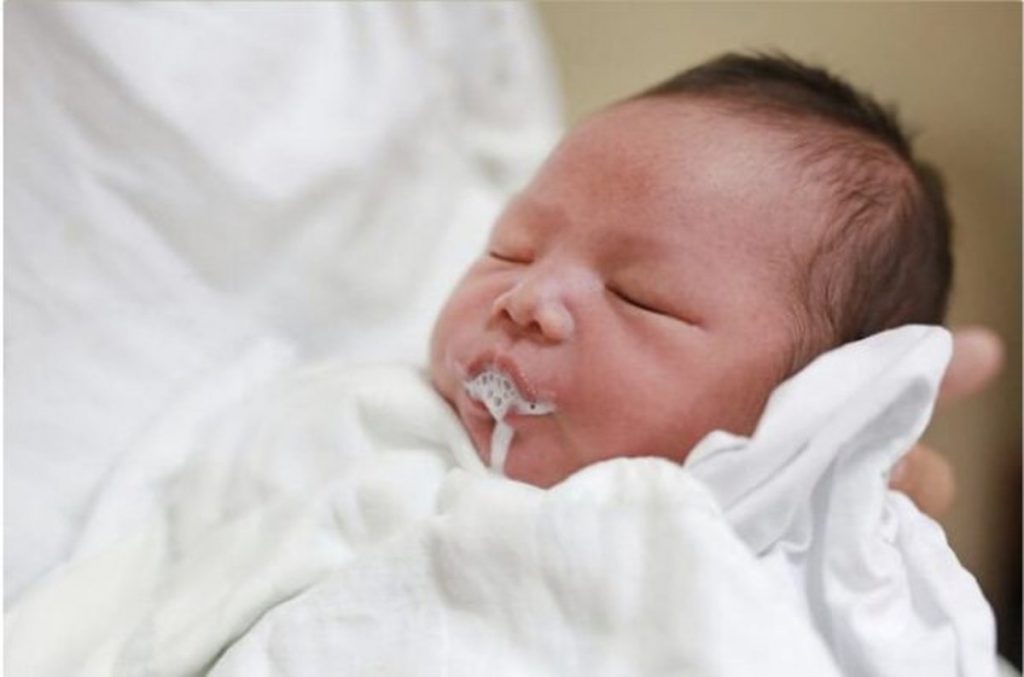 Bé bị sặc sữa nhiều lần mẹ lại không để tâm, đến lúc vào bệnh viện mới bàng hoàng, hối hận