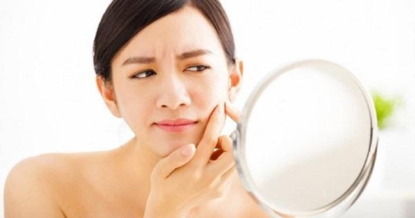 Chăm sóc da thời kỳ kinh nguyệt – Bạn đã làm đúng cách chưa?