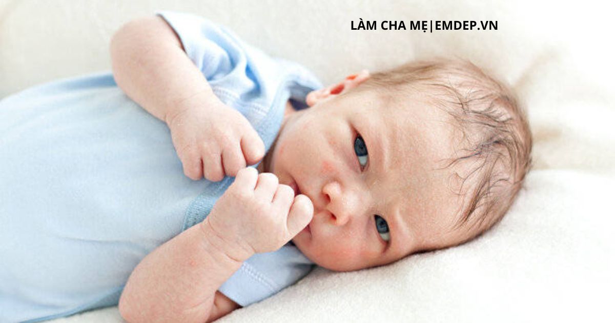 Vào ngày hè vì sao nếp gấp da cổ của bé lại mẩn đỏ lên?