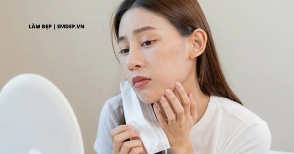 Hé lộ ‘bí kíp’ chăm sóc da mụn do đeo khẩu trang cực đơn giản lại hiệu quả nàng chớ nên bỏ qua