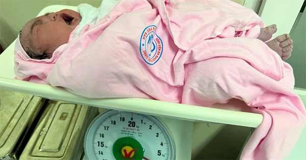 Bé gái chào đời nặng 6,2 kg gây bất ngờ cho cả kíp mổ và mẹ

