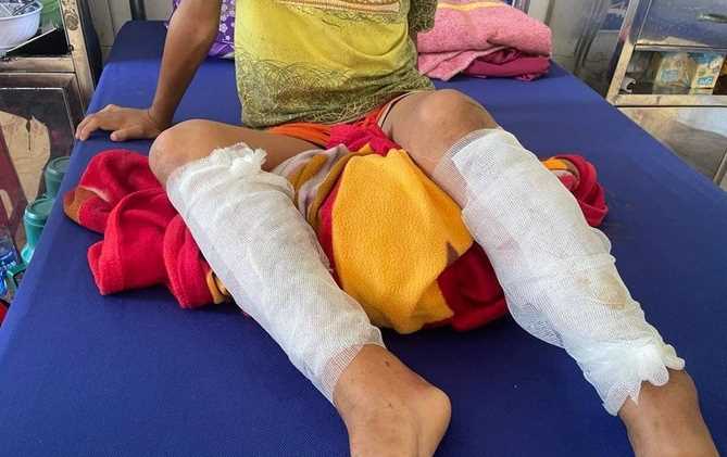 Học sinh lớp 3 bị cha ruột trói, dùng xăng đốt chân

