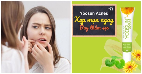 Cách làm xẹp mụn bọc nhanh, ít thâm bạn đã biết!