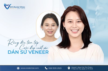Đón đầu làn sóng thẩm mỹ nụ cười 'mặt dán sứ Veneer' tại Nha Khoa VIX