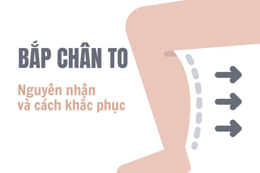 Top 3 cách làm bắp chân nhỏ lại nhanh nhất