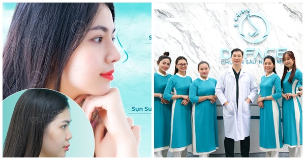 Có nên lựa chọn nâng mũi tại Viện nâng mũi DR.FACE?