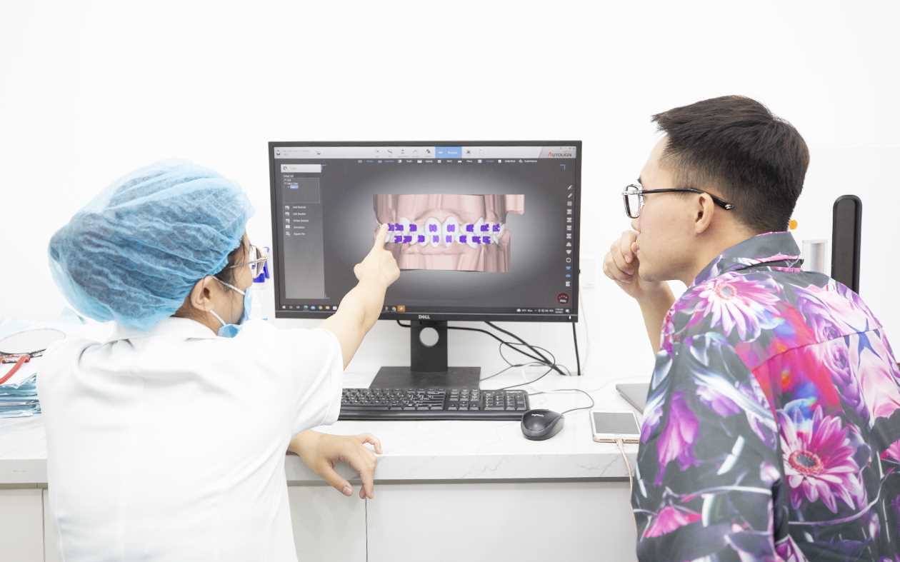 Cơ chế hoạt động và ưu điểm của mắc cài tự động