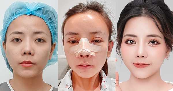 Sau 6 giờ 'bác sĩ can thiệp' 9X thay đổi ngỡ ngàng, 'vịt hóa thiên nga' ấn tượng