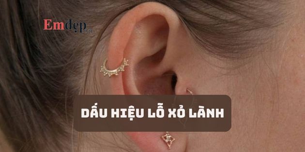 5 dấu hiệu lỗ xỏ lành và cách để lỗ xỏ mau lành không nhiễm trùng