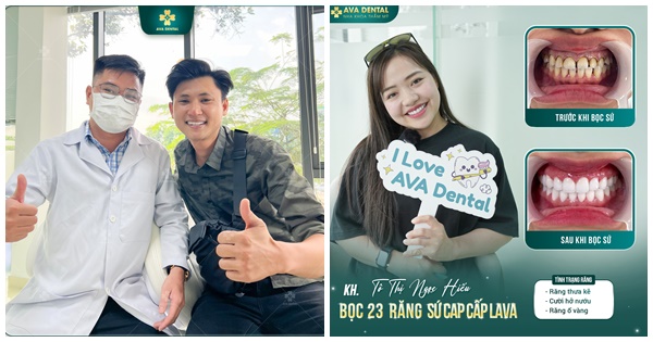 Địa chỉ uy tín bọc răng sứ Lava cao cấp tại Tp. HCM
