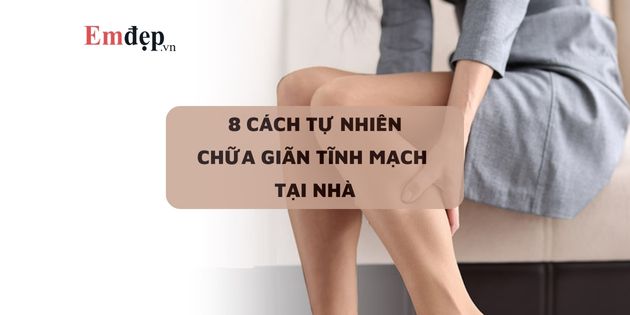 8 cách tự nhiên chữa giãn tĩnh mạch đơn giản tại nhà