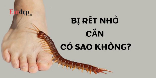 Bị rết nhỏ cắn có sao không? Bị rết nhỏ cắn phải làm sao?