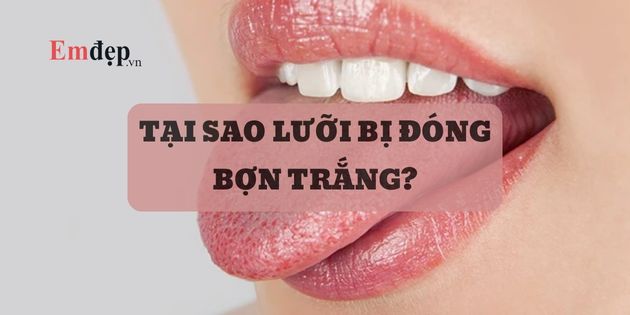 Tại sao lưỡi bị đóng bợn trắng? Cách làm sạch lưỡi bị trắng