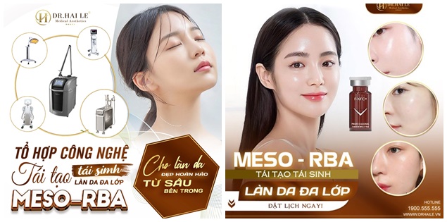 Trào lưu làm đẹp da 'căng bóng' bằng công nghệ Meso-RBA nở rộ