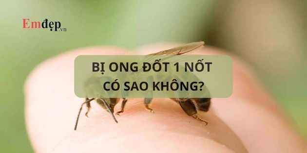 Bị ong đốt một nốt có sao không? Cách xử lý khi bị ong đốt một nốt