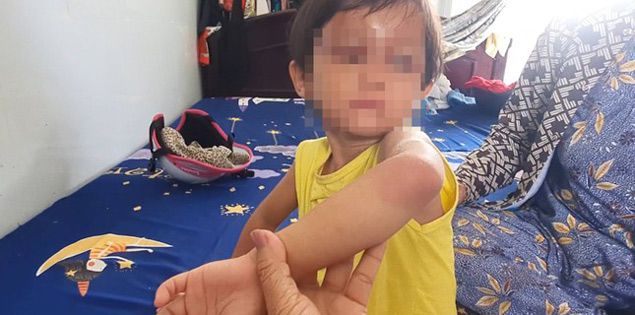 Bé gái bị cha nuôi đánh ở Cà Mau được đưa vào trung tâm bảo trợ diện "bảo vệ khẩn cấp"

