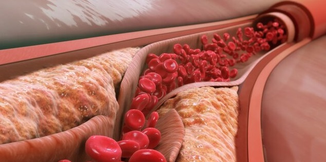 Bỏ túi 6 cách giảm cholesterol đơn giản và an toàn này để Tết này luôn khỏe mạnh