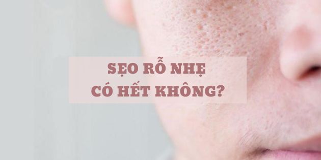 Sẹo rỗ nhẹ có hết không? Cách trị sẹo rỗ nhẹ nhanh nhất