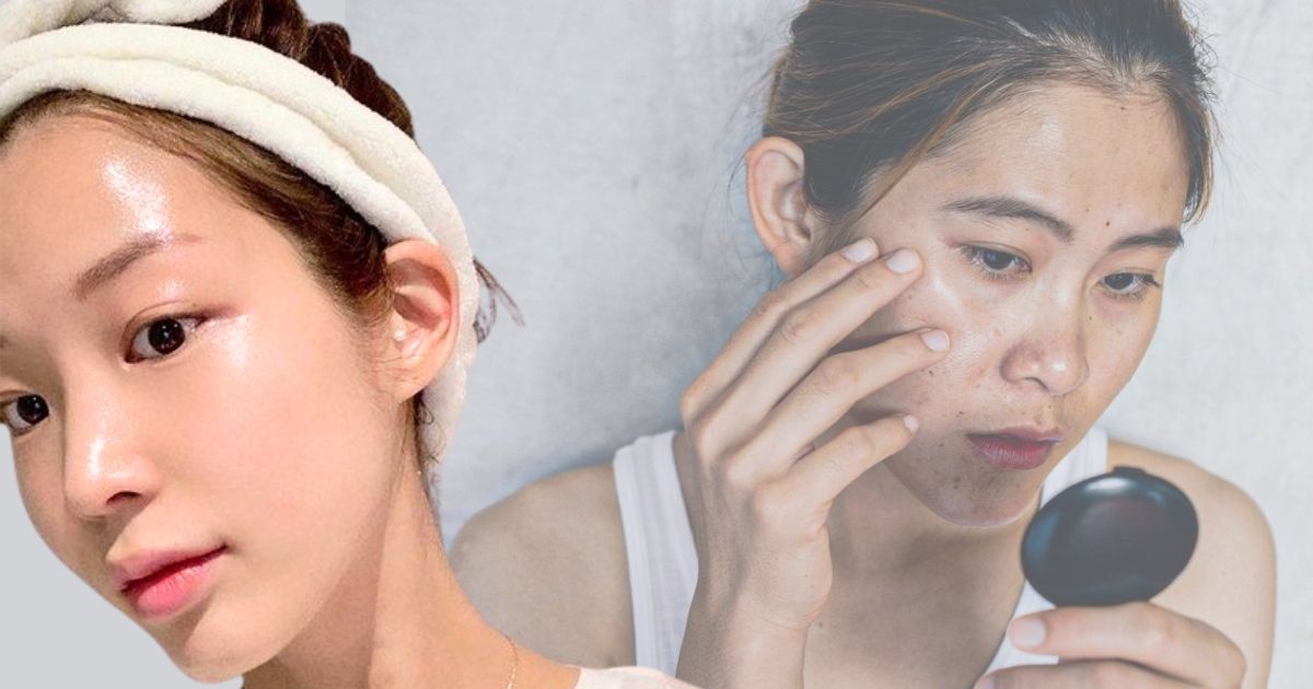 3 thành phần dưỡng trắng chính giúp bạn cải thiện làn da, ngoài Niacinamide, Vitamin C còn thành phần nào?