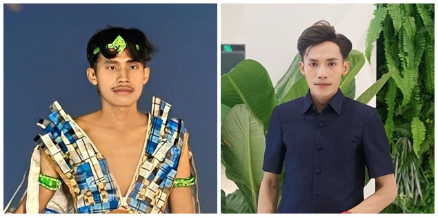 Diện mạo bất ngờ của thí sinh hot nhất Nam vương Campuchia sau khi sang Việt Nam 'nhờ bác sĩ can thiệp'