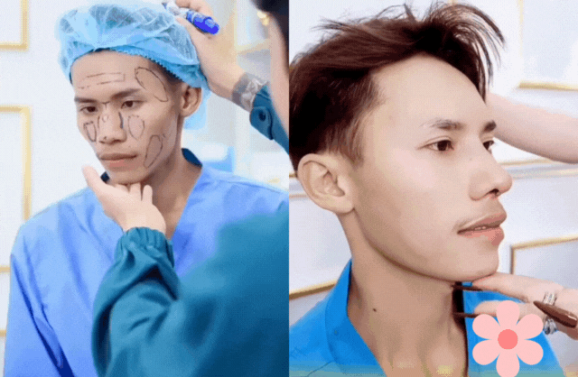 Diện mạo bất ngờ của thí sinh hot nhất Nam vương Campuchia sau khi sang Việt Nam 'nhờ bác sĩ can thiệp'