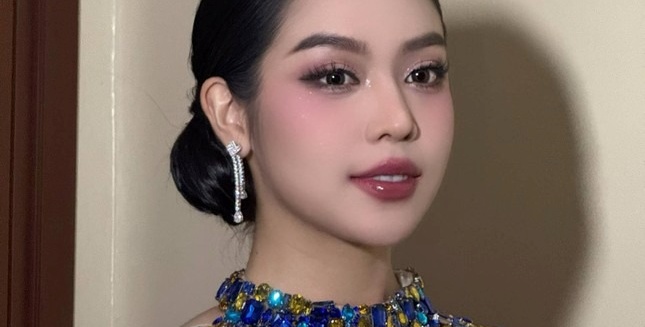 Hoa hậu Thanh Thủy nhập viện ở Indonesia