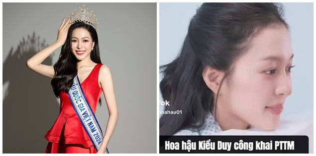 Một nàng Hậu công khai "chỉnh sửa" trước thêm thi nhan sắc quốc tế
