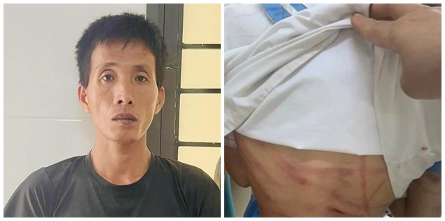 Cha dượng dùng búa đinh, gậy gỗ hành hung bé gái lớp 5 ở Hà Tĩnh