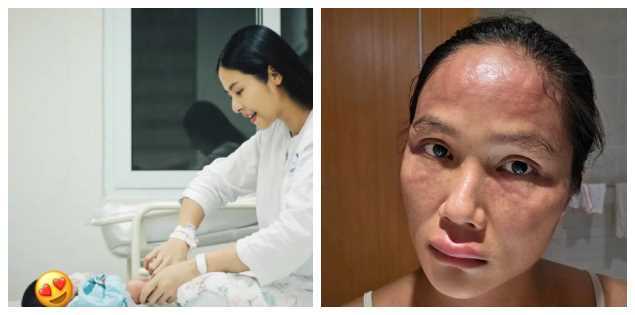 Một hoa hậu mắc bệnh hiếm giống H'Hen Niê sau khi sinh con ở tuổi 36