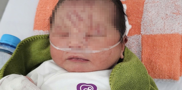 NÓNG: Một trẻ sơ sinh nghi bị "chôn sống" tại vườn cao su