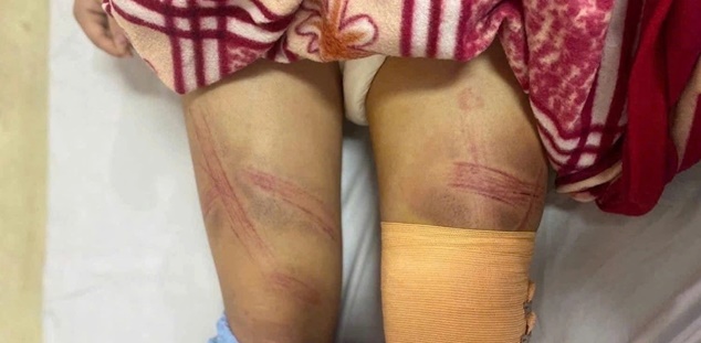 Vụ bé gái lớp 7 bị bố đánh nhập viện ở Nghệ An: Nguồn cơn từ con lợn đất?