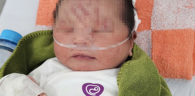 Bé sơ sinh bị vùi lấp ở Gia Lai chính thức được nhận nuôi