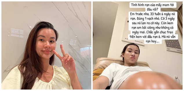 Sao nữ Việt tốn cả chục triệu đồng mua kem rạn da khi mang song thai