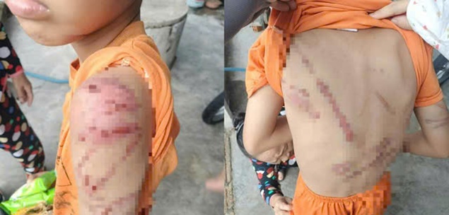 Lý do người cha đánh con 10 tuổi bầm tím khắp người